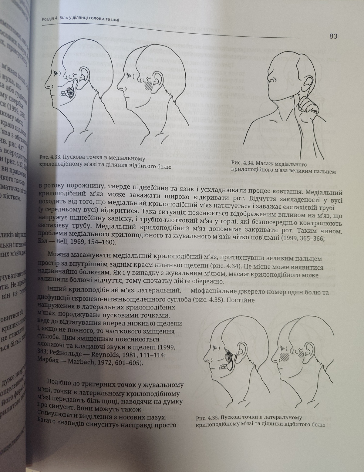 Тригерні точки. Покрокове керівництво по терапії хронічних м'язових і суглобових болів. Девіс А. українською мовою великий формат